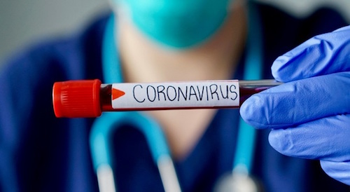 Corigliano-Rossano | Coronavirus: sono 10 i nuovi casi di oggi/LA TABELLA
